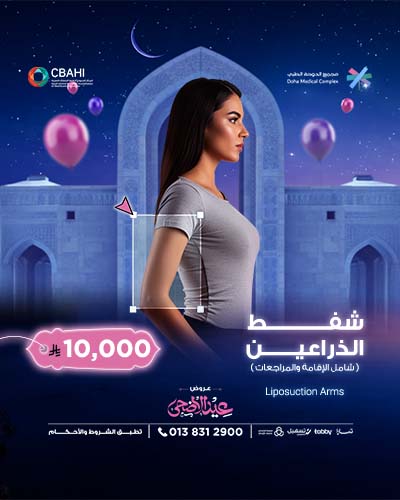 شفط الذراعين