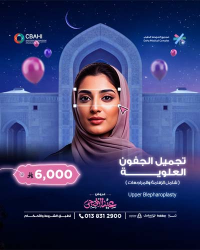 تجميل الجفون العلوية