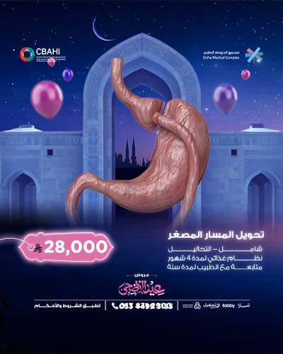 تحويل المسار المصغر