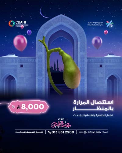 استئصال المرارة بالمنظار