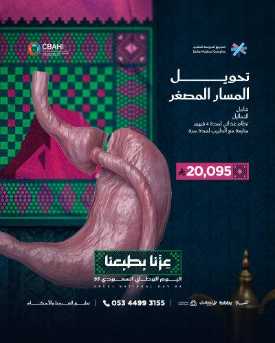 تحويل المسار المصغر