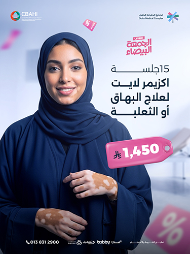 15  جلسات اكزيمر لايت لعلاج البهاق او الثعلبة