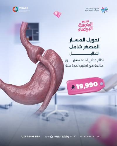 تحويل المسار المصغر