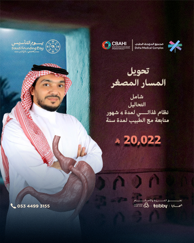 تحويل المسار المصغر