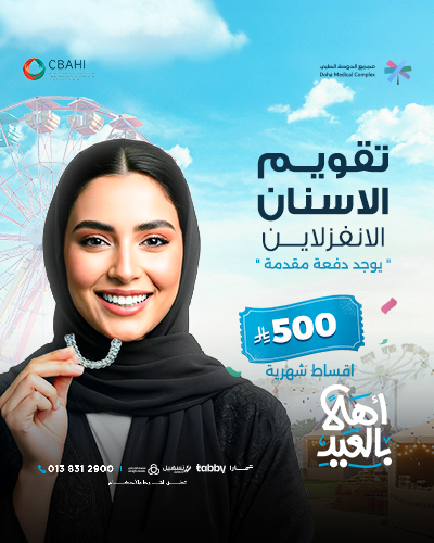 تقويم الاسنان الانفزلاين