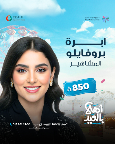 ابرة بروفايلو المشاهير