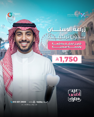 زراعة الاسنان بدون تركيبة