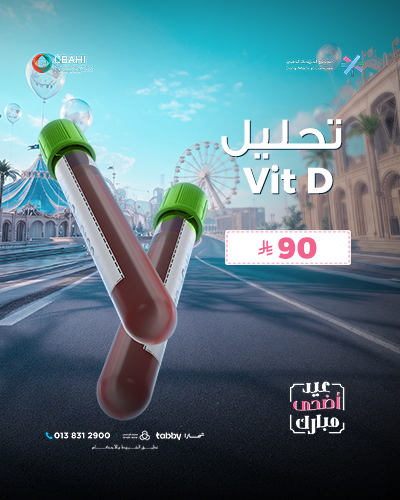 تحليل Vit D