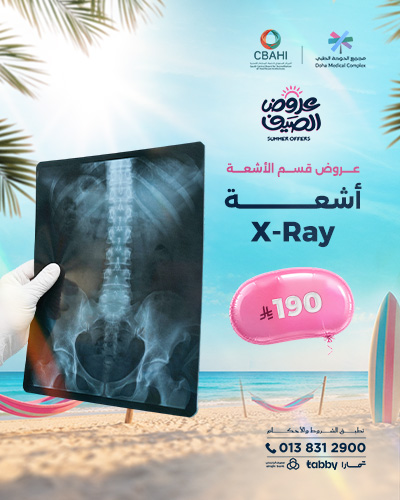 أشعة X-Ray
