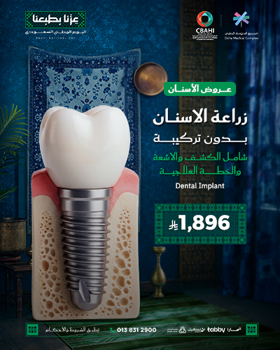 زراعة الاسنان بدون تركيبة
