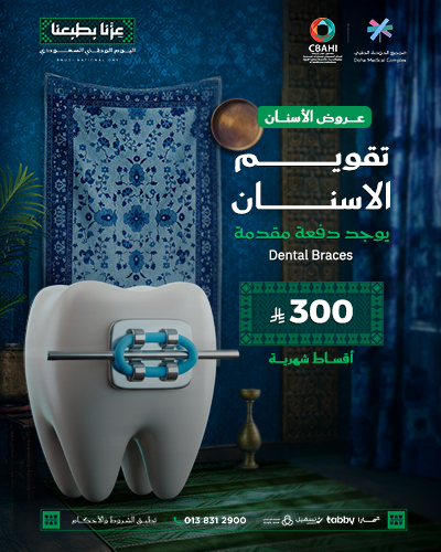 تقويم الاسنان