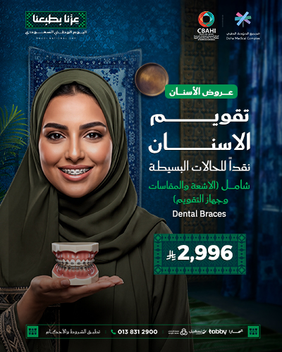 تقويم الأسنان نقداًللحالات البسيطة