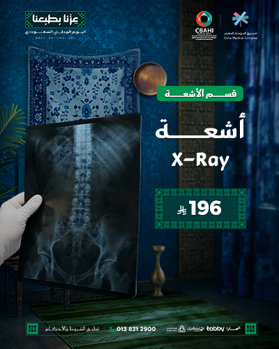 أشعة X-Ray